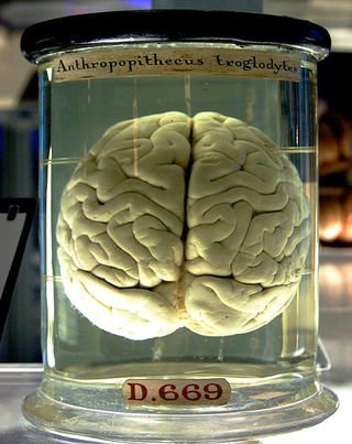 476px-Chimp_Brain_in_a_jar