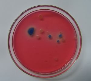 Petri-dish-agar-135593-l